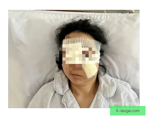 格罗索执教里昂大巴遭球迷袭击 面部受伤缝针引发关注 格罗索执教里昂大巴遭球迷袭击 面部受伤缝针引发关注